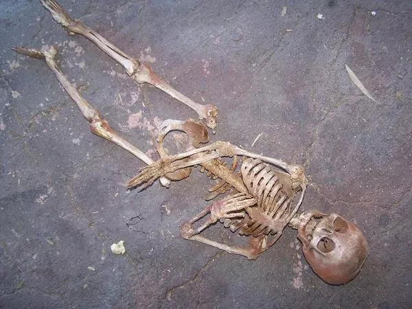 Person Skeleton Find out In Warangal  - Sakshi