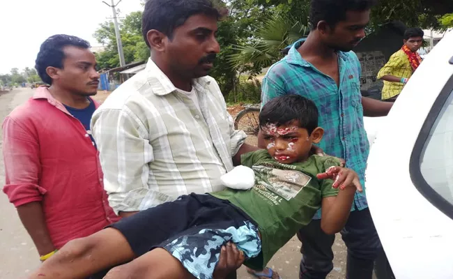 In Khammam Current bulb explodes Boy Injured  - Sakshi