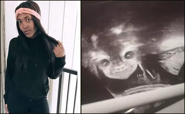  Virginian Pregnant Mum Shocked As Scan Reveals Devil Baby - Sakshi