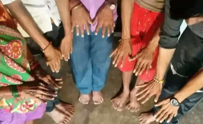 Madhya Pradesh All 25 Members Has More Than 10 Fingers - Sakshi