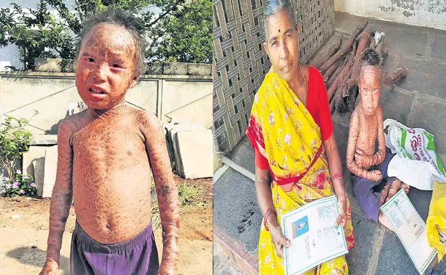 Boy Suffering With Unknown Disease From Four Years At Prakasam District - Sakshi