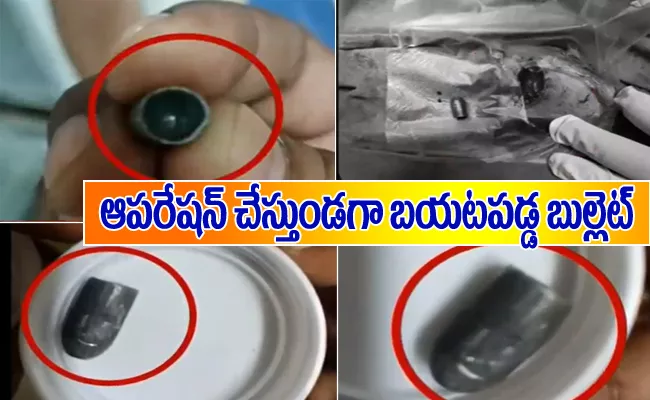 Bullet Extract From Young Lady Body In NIMS Hospital Hyderabad - Sakshi