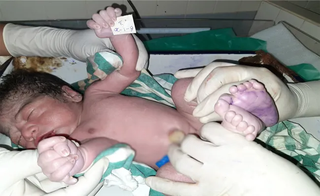 Baby Born With 24 Fingers in Vizianagaram - Sakshi