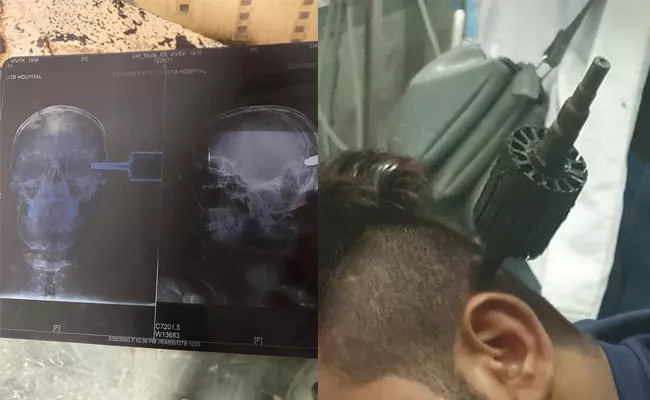 X Ray Shows Rioters Pushed Drill Machine Into 19 Year Old Head - Sakshi