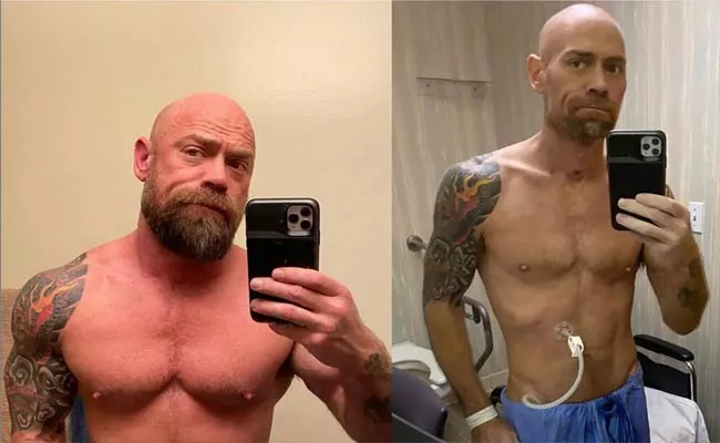 California Man Shares Body Transformation Pics By Infected With Coronavirus - Sakshi