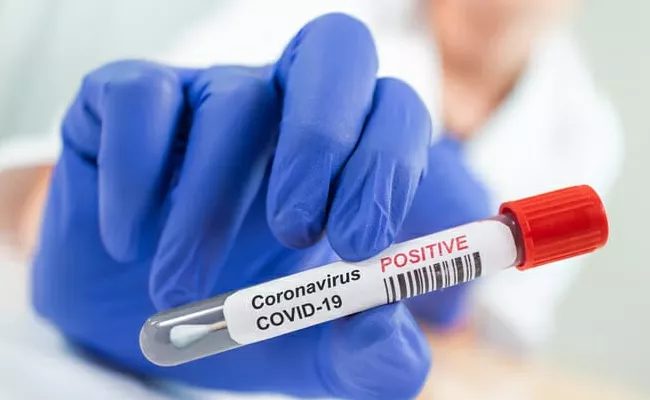 Coronavirus 164 Positive Cases Reported In Telangana State - Sakshi