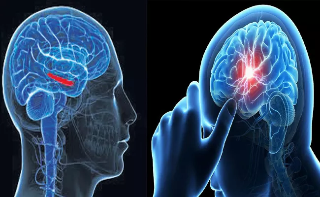 Brain injury markers in severe COVID-19 patients identified - Sakshi