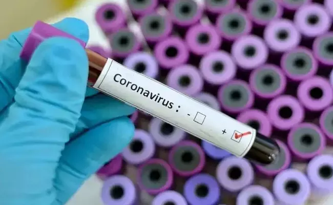 COVID-19: Corona virus Updates from around the world - Sakshi