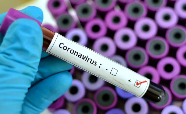 CoronaVirus: 147 More Positive Cases Registered In AP - Sakshi