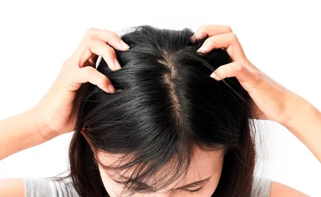 Health Tips How To Get Rid Of Head Lice - Sakshi