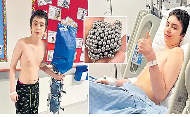 England Boy Swallows 54 Magnetic Balls To See If He Turns Magnetic - Sakshi