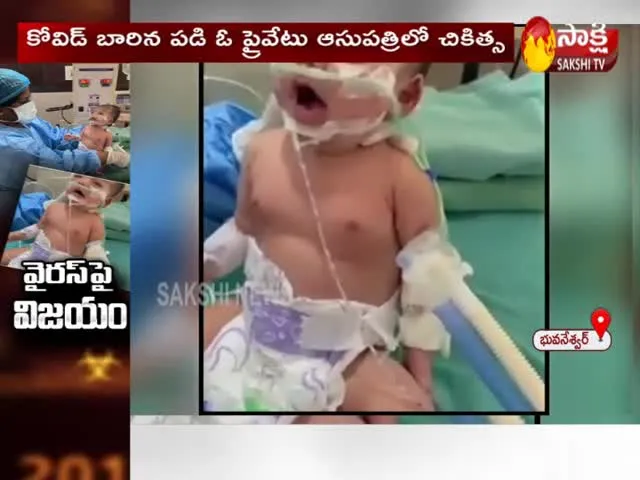 New Born Baby Covid Infect Recovers 10 Days Ventilator