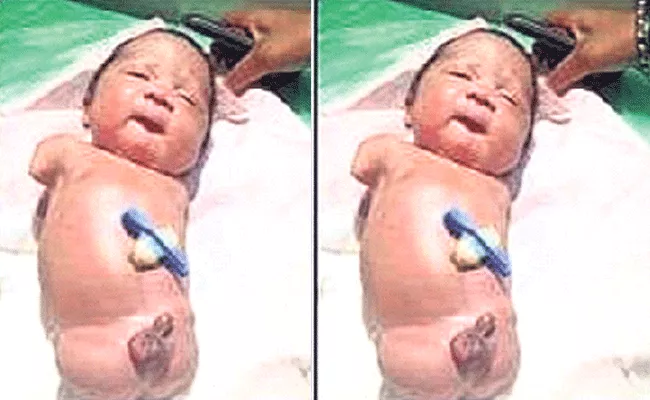 New Born Baby Without Hands And Legs In Odisha - Sakshi