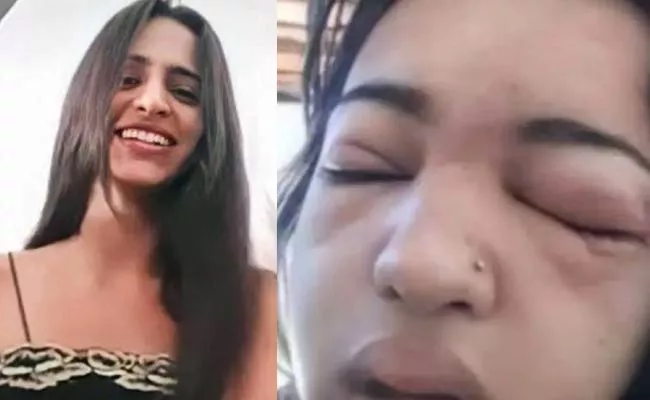 Brazil Beautiful Teenager Deceased After Self Piercing Infection - Sakshi