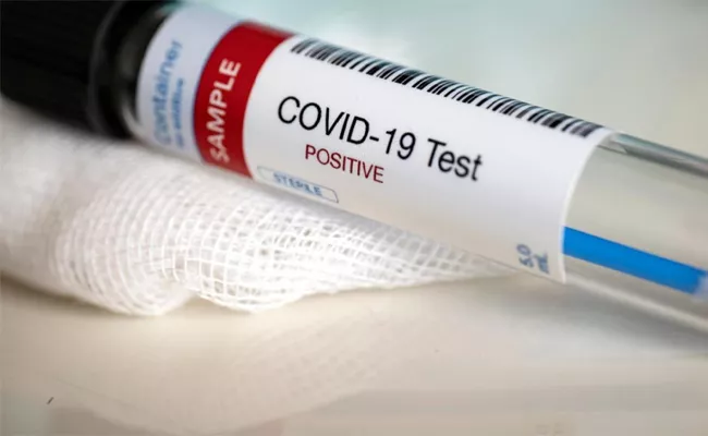 Andhra Pradesh New Corona Virus Positive Cases Recorded - Sakshi