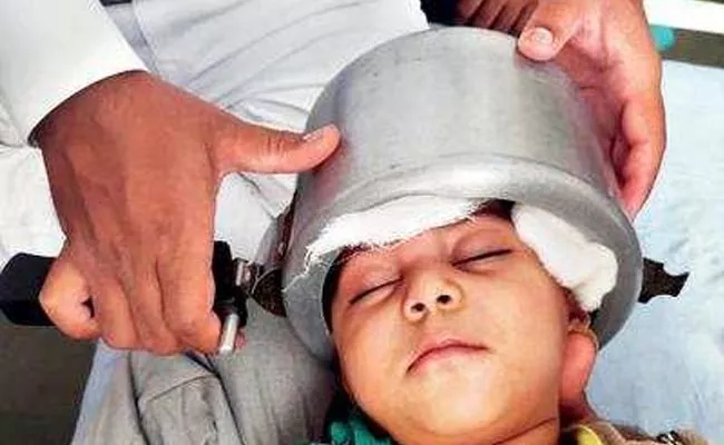 Little Boy Head Stuck Inside Pressure Cooker In Agra - Sakshi