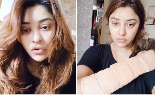 Payal Ghosh Injured After Suspected Acid Attack - Sakshi