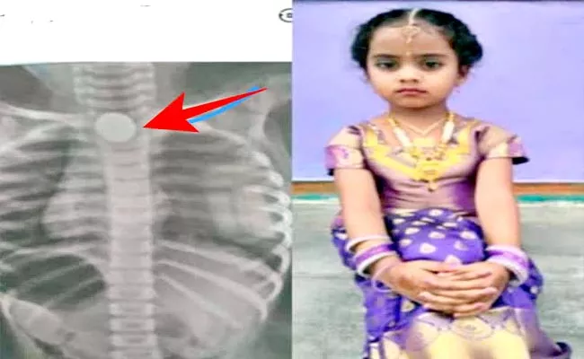 4 Years Girl Lost Life After Coin Struck In Throat Karnataka - Sakshi