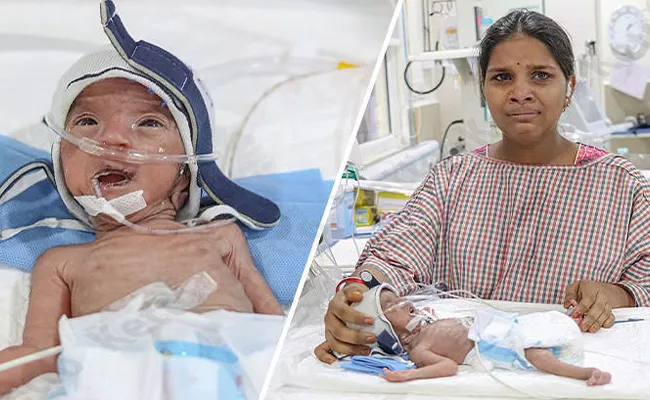 Preterm Babies Can Not Breathe Will You Help Them - Sakshi