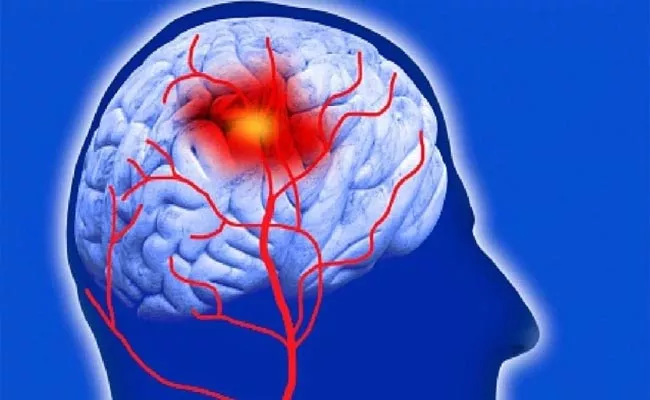 World Stroke Day 2021: Threat of Brain Stroke in Post Covid Patients - Sakshi