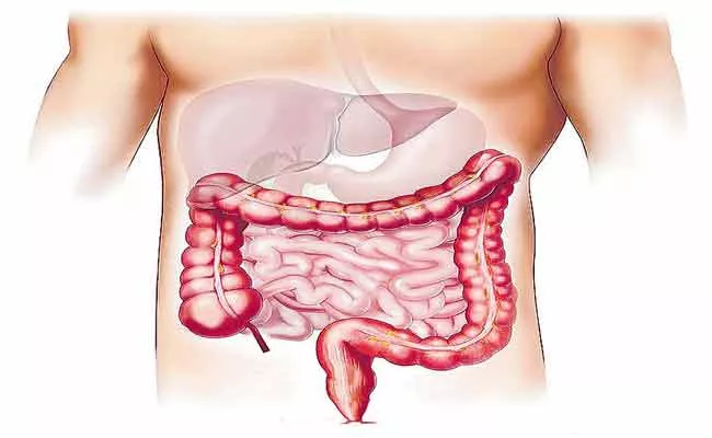 Post Covid Effect On Intestines - Sakshi