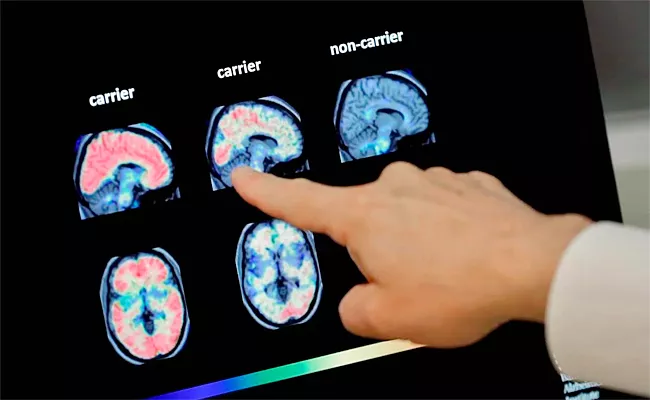 Mysterious Brain Disease Spreading In Canada - Sakshi