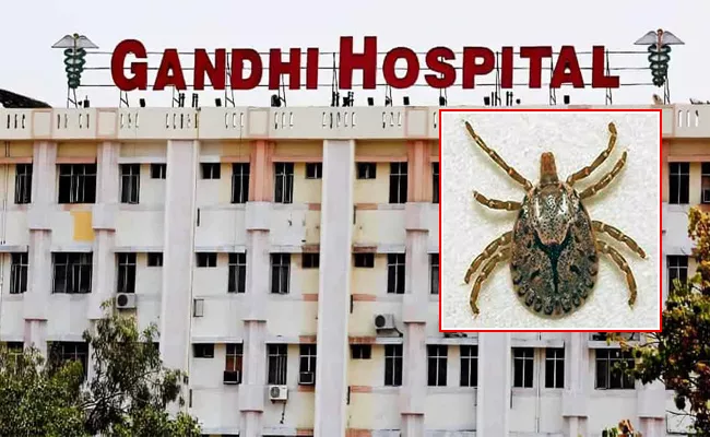 Hyderabad Gandhi Hospital: New Disease Plaguing Scrub Typhus Reports 15 Cases - Sakshi