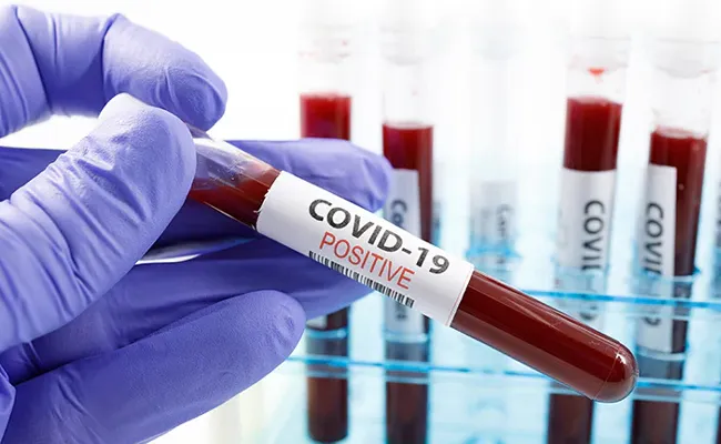 Coronavirus: 2983 New Covid Positive Cases Registered Telangana - Sakshi