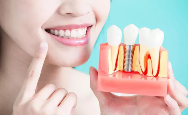 Tooth Decay Why Need To Implant Teeth Replacement Of Missing One - Sakshi