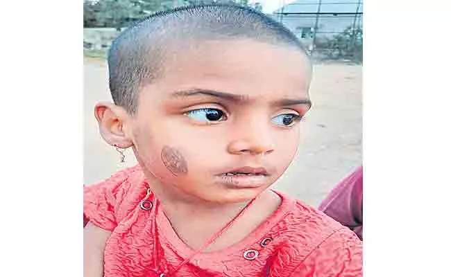 Anganwadi Teacher Cruel Behaviour On Child In Nalgonda - Sakshi