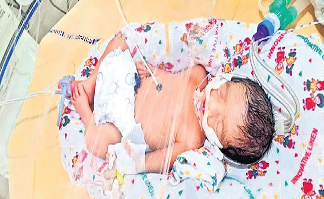 Warangal: Parents Need Help To Their Twin Sons Over Organ Growth Defect - Sakshi