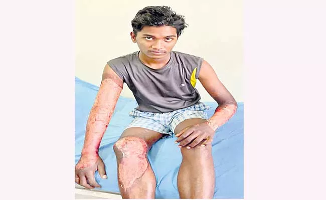 Gurukul Student Injured Badly While Sambar Fell On His Dung Sangareddy District - Sakshi