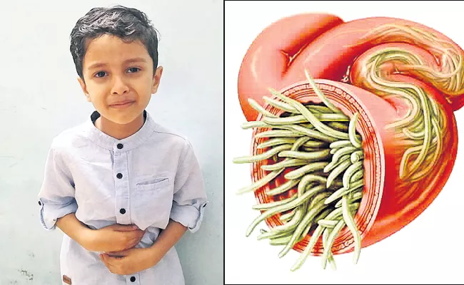 Albendazole tablets for childrens for prevention of weevils - Sakshi