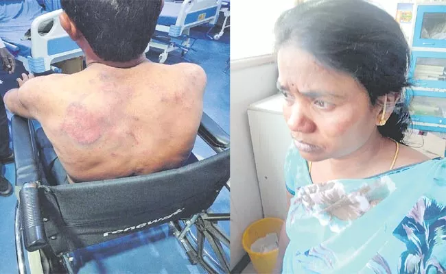 KPHB Colony: Lovers Elope From House, Girl Parents Attack On Lover Family - Sakshi