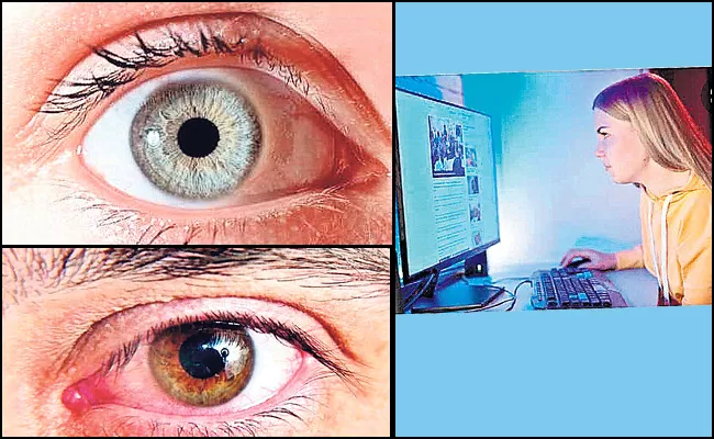 Dry Eyes Blindness Avoid Digital Screen Use Remedies In Telugu - Sakshi