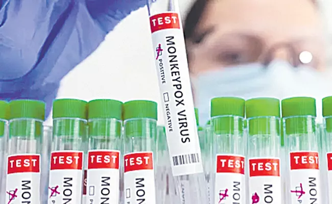 Trivitron creates RT-PCR test kit to detect Monkeypox virus - Sakshi