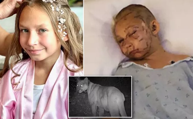 Meet Lily Kryzhanivskyy Who Survived From Rare Cougar Attack - Sakshi