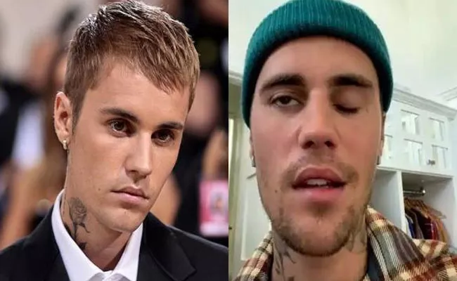 Justin Bieber Says He Suffer With Face Paralysis After Virus Attack - Sakshi