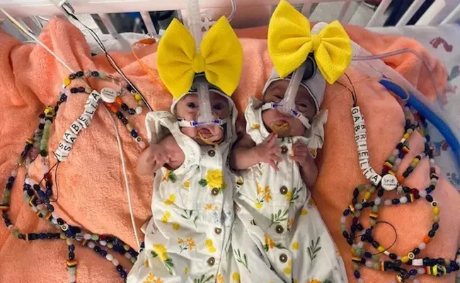 Mom Gives Birth To Identical twins 3 Days Apart In Texas - Sakshi