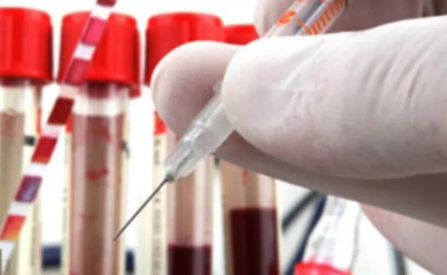 Unique Blood Group Found in Elderly Man First case in India - Sakshi