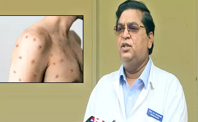 Telangana Health Officials On Kamareddy resident Monkeypox Symptoms - Sakshi