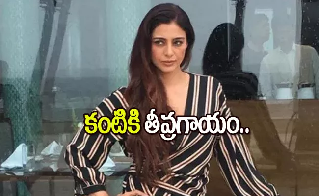 Actress Tabu Gets Injured On The Sets Of Ajay Devgans Bholaa In Hyderabad - Sakshi