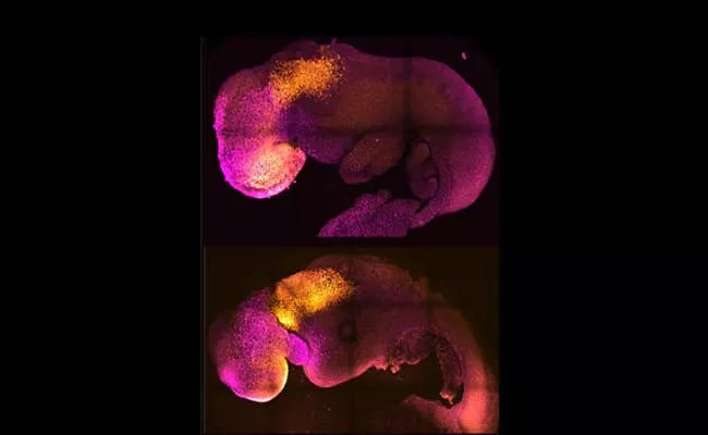 Worlds First Synthetic Embryo That Has Brain Beating Heart  - Sakshi