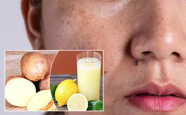 Beauty Tips In Telugu: Home Remedies For Get Rid Of Pigmentation - Sakshi