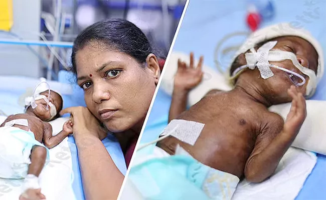 Physically Disabled I Cant Afford To Save My Newborn Please Help - Sakshi