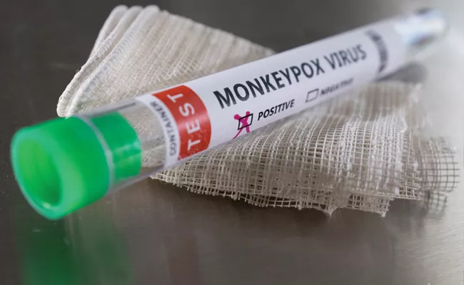 Over 30 Children Test Positive For Monkeypox In US - Sakshi