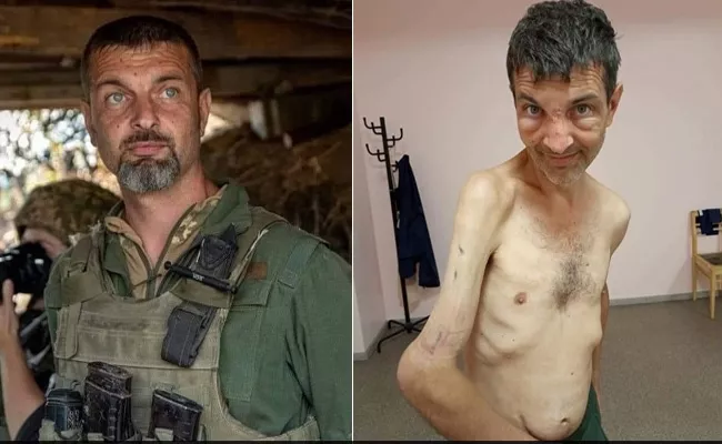 Shocking Pictures oF Ukrainian Soldier Survived Russian Captivity - Sakshi