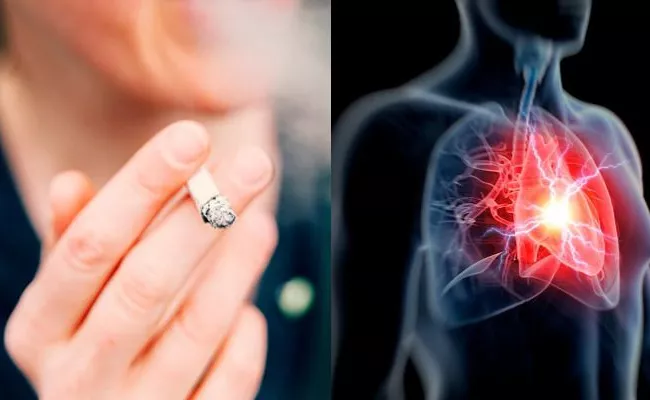 60 Percent Of Heart Attack Cases Are Due To Smoking Heart Specialist Dr Prabhakar - Sakshi