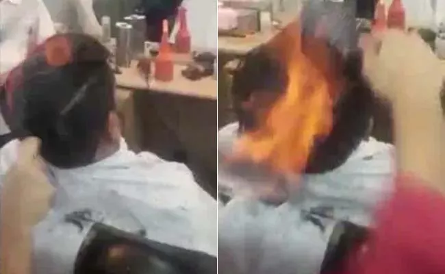 18 Year Old Man Suffered Severe Burn Injuries After Fire Hair Cut - Sakshi