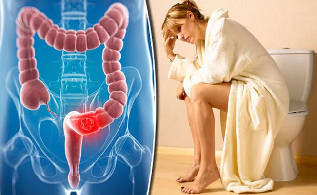 Same Symptoms For Piles And Cancer - Sakshi